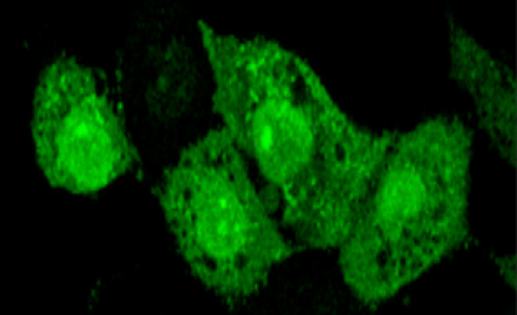 Fig.2 Fig.2